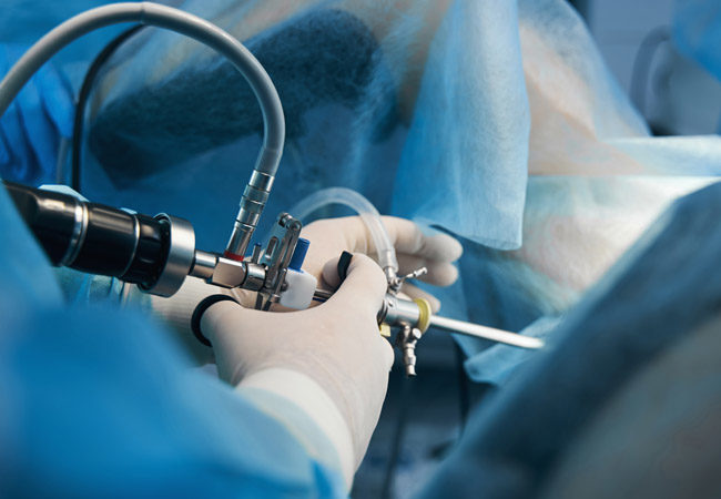 “Surgeons performing minimally invasive hysteroscopy surgery using camera and instruments.”