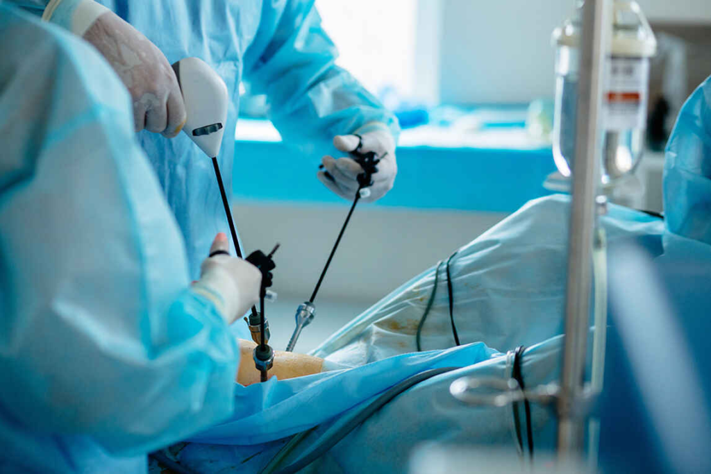 “Surgeons performing minimally invasive laparoscopic surgery using camera and instruments.”